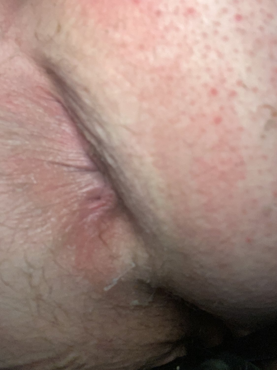 Daddy Slut's Combo Stretch: All Toys in Bottom Hole #uYgToUvQ